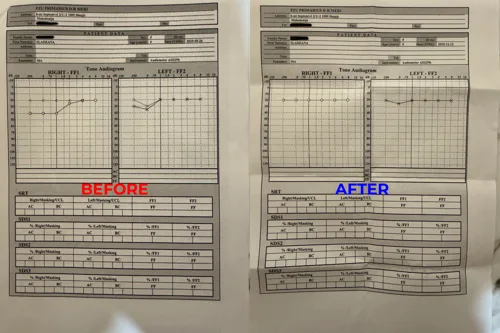 Preview of the original document from Hearing comparison